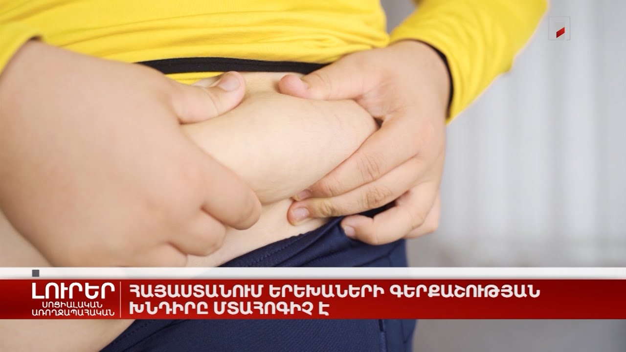 Հայաստանում երեխաների գերքաշության խնդիրը մտահոգիչ է