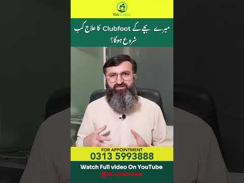 When will my children's clubfoot treatment start? #clubfoot