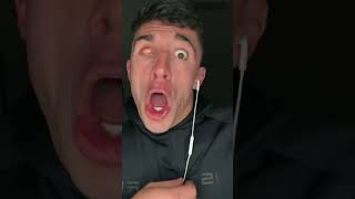 Download lagu My Eye ball slpped out #shorts🤪 mp3