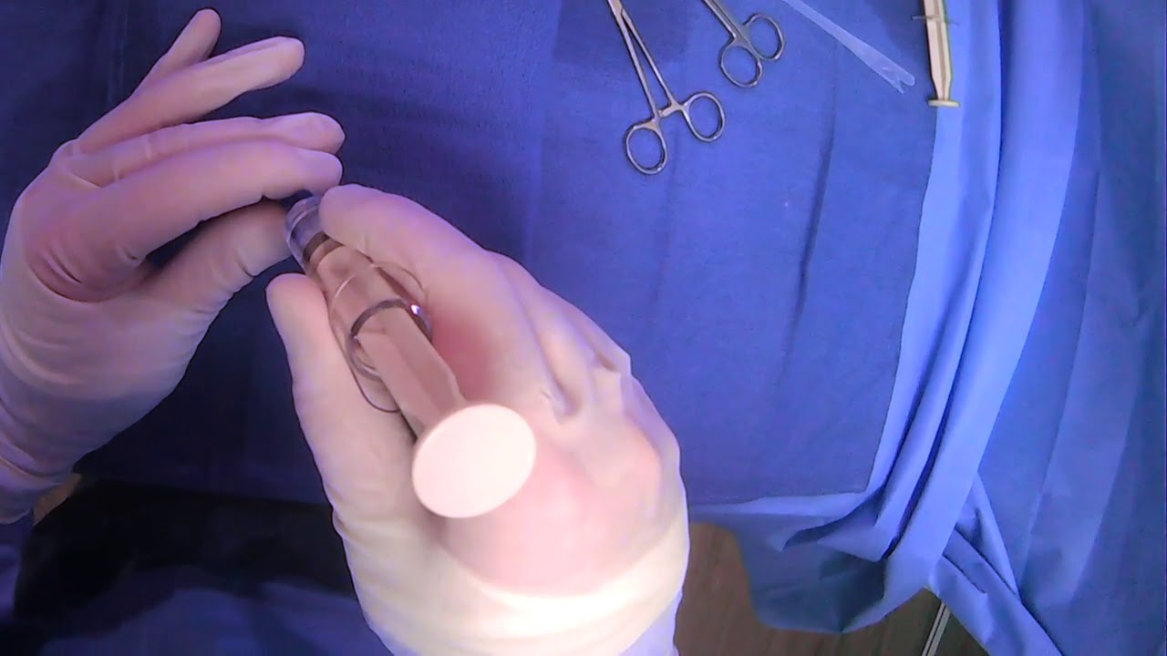 Watch video Using Gastrointestinal Anchors (T-Fasteners/T-Pexy Devices) Now Using Gastrointestinal Anchors (T-Fasteners/T-Pexy Devices)