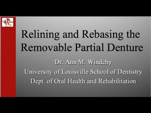 Relines and Rebase for RPD