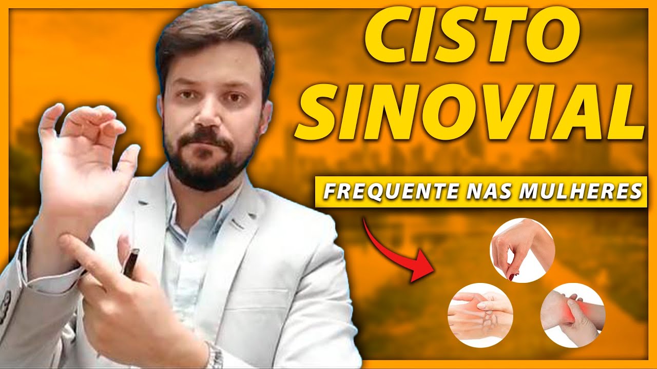 CISTO SINOVIAL | O QUE É