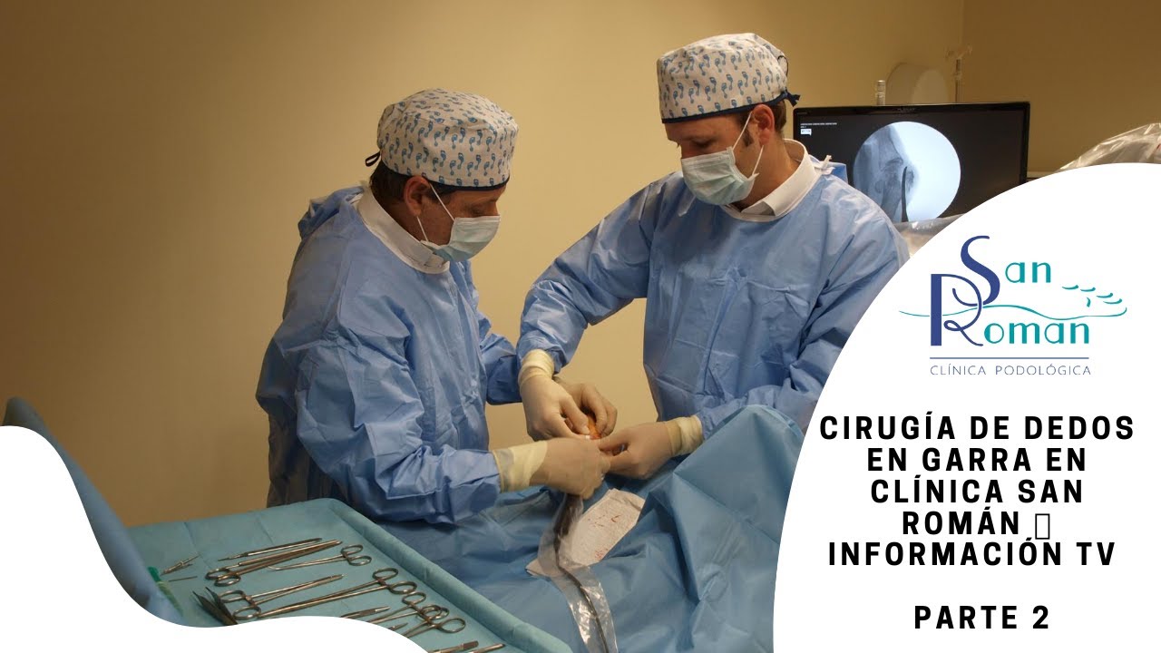 Cirugía de dedos en garra en Clínica San Román ?? Información TV - PARTE 2