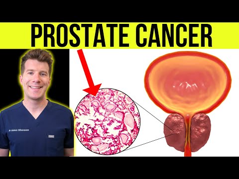 What is PROSTATE CANCER? Doctor explains SIGNS, SYMPTOMS, TREATMENT and more!