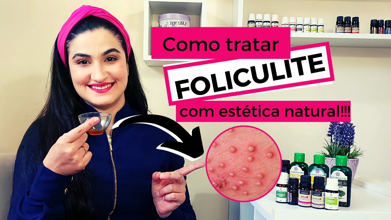 Como tratar FOLICULITE com estética natural!