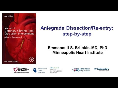 Antegrade dissection and re-entry: step-by-step