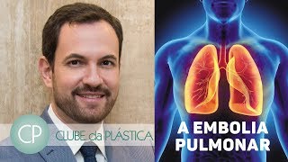 O Que Causa Embolia Pulmonar Em Uma Cirurgia