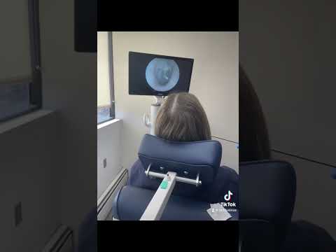 What a normal ear drum looks like vs a retracted ear drum