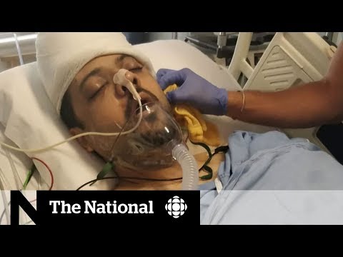 Wife of beaten Ontario man: Hate is alive here