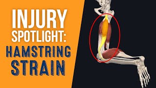 Injury Spotlight: Hamstring Strain