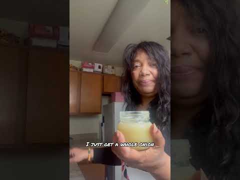 Onion Juice All Over My Head #vlog #alopecia #hair #dermatology  