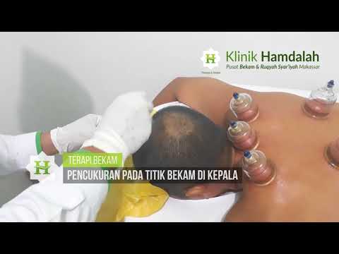 Membawa seorang wanita untuk batas Bagaimana meningkatkan panjang penis tanpa operasi