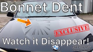 BMW X4 SUV BONNET DENT - WATCH IT DISAPPEAR with PDR / By Dent-Remover ltd