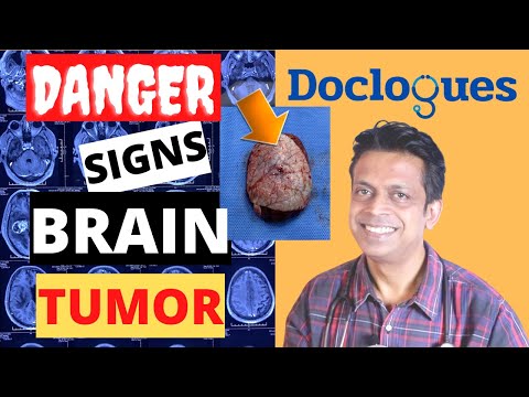 Danger Signs of a Brain Tumor