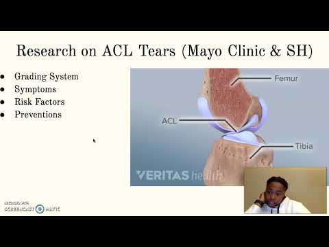 The Biomechanics of ACL Tears