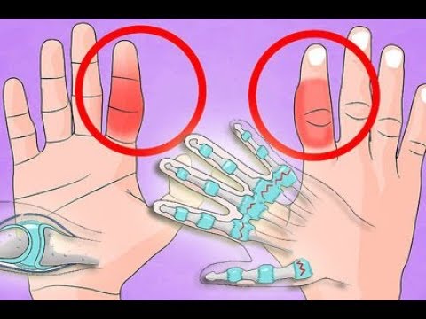 Warum es tut weh, die Haut im Bereich der Lendenwirbelsäule Infusion von Kräutern in Osteochondrose