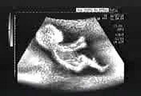 šumachr je ryclej ! závodí i v břiše !