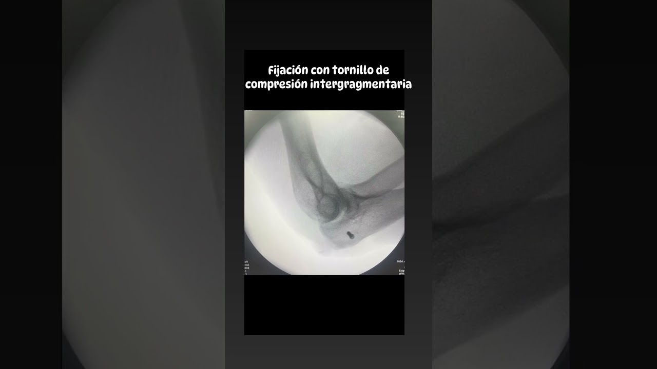 Helberth Augusto González Rico-3