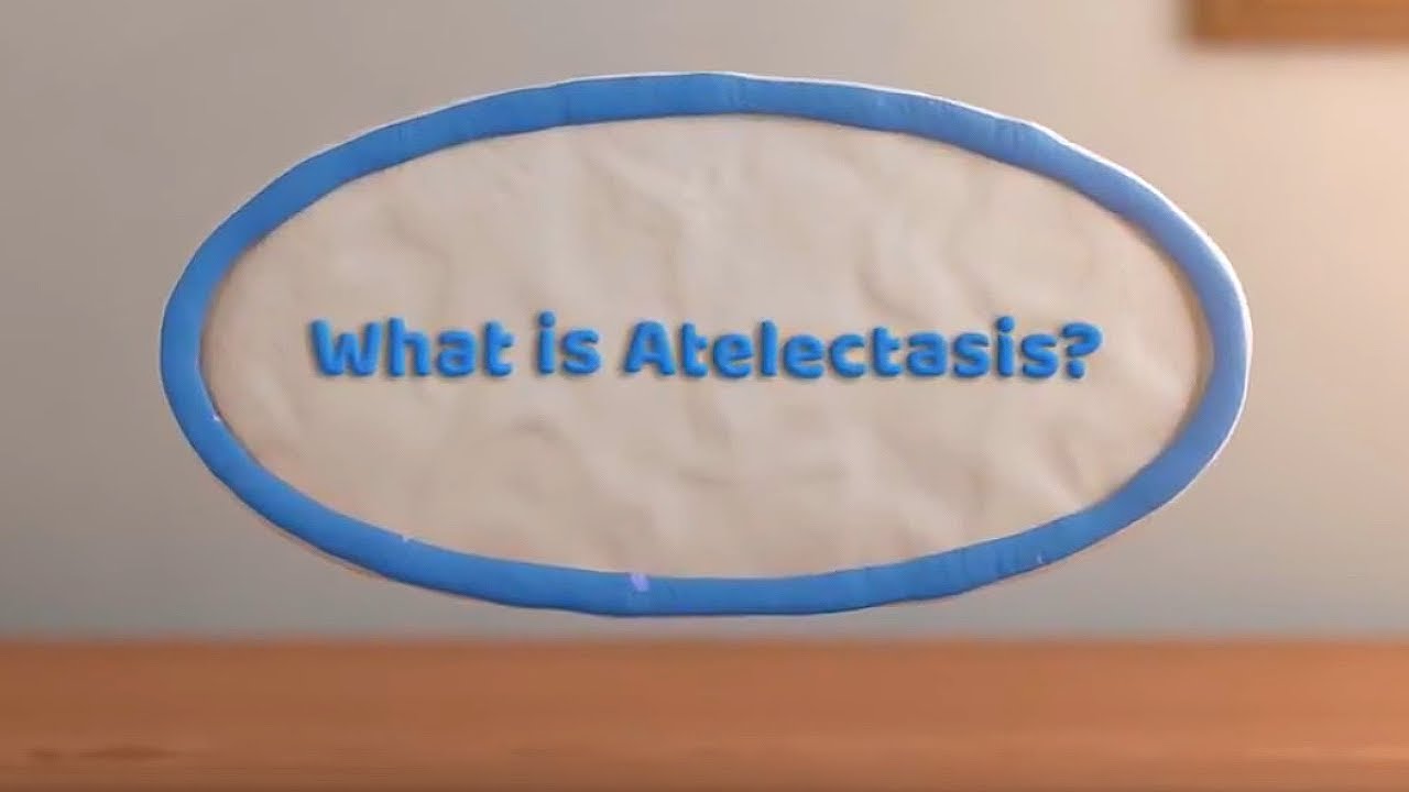 What is Atelectasis? (Complete or Partial Lung Collapse) - YouTube