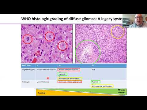 Pathology Grand Rounds | Dr. PJ Cimino