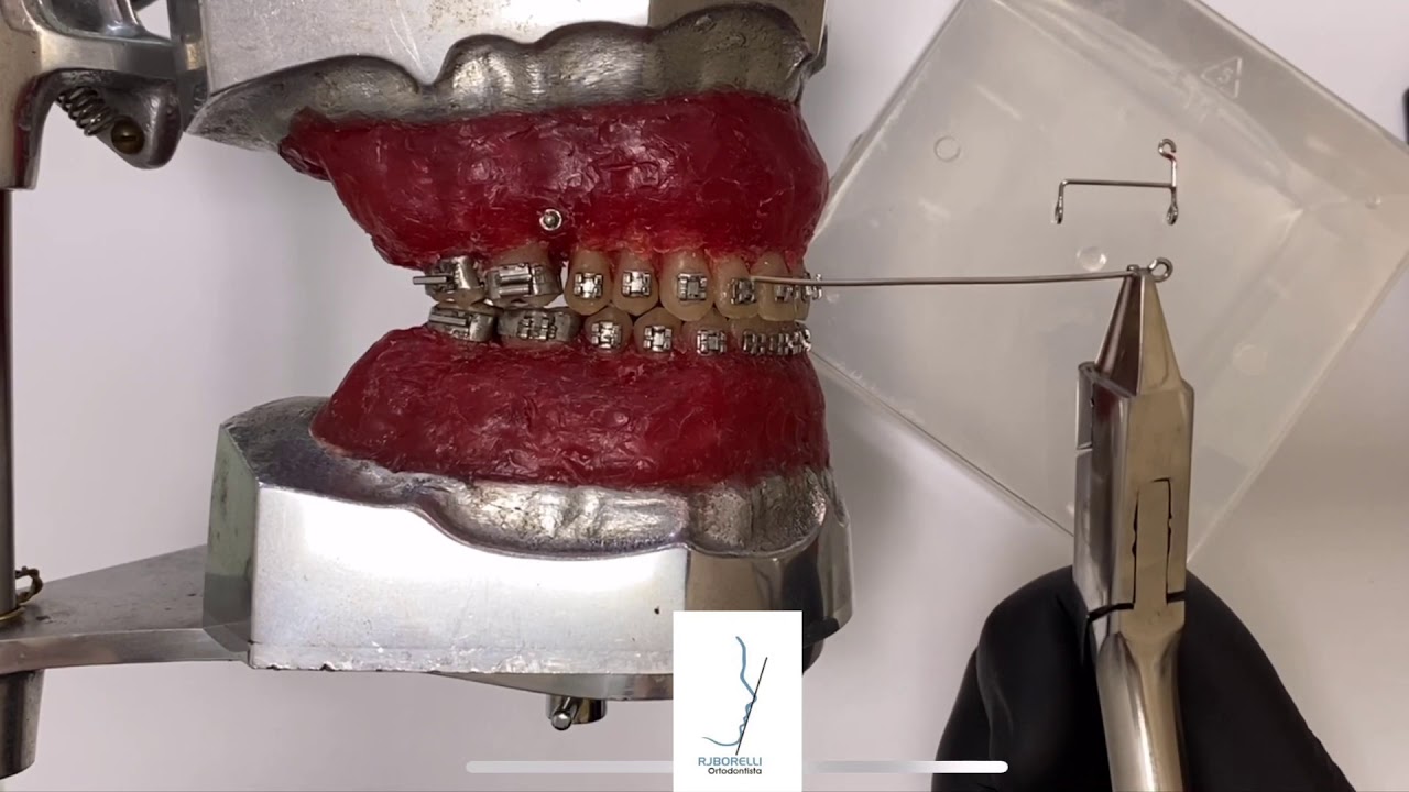 Watch Now Cursor para Mini-Implantes Cursor para Mini-Implantes