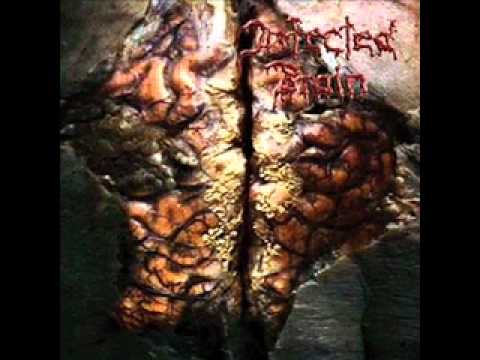 Infected Brain - Cancer
