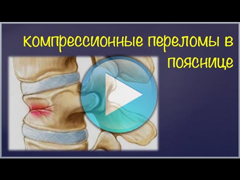 Gymnastik in Chondrose BWS Video Übungen in der zervikalen Osteochondrose thorakalen 2