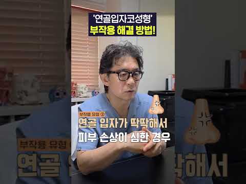 ‘연골입자 코성형’ 한 사람 필독, 부작용 터지면 이렇게 됩니다