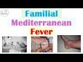 Familial Mediterranean Fever Pathophysiology Symptoms Diagnosis Treatment