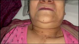 Asvide: Presents the clinical assessment (via inspection and palpation) of an elderly male patient..