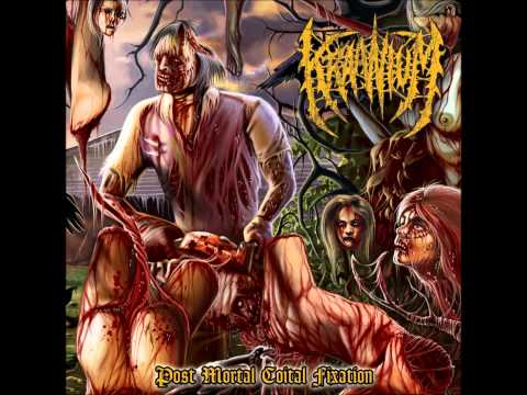 Kraanium - Post Mortal Fixation