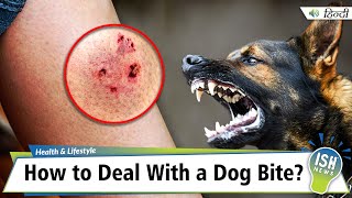 How to Deal With a Dog Bite?