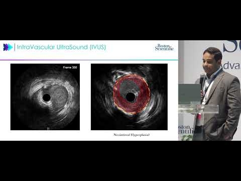 TCT 2024 Case Study | AGENT Drug-Coated Balloon Presented by Dr. Jubin Joseph, MD, PhD