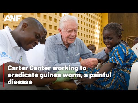 Carter's legacy: Eradicating guinea worm disease