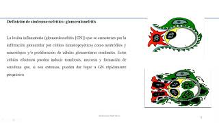 Sindrome nefrítico.