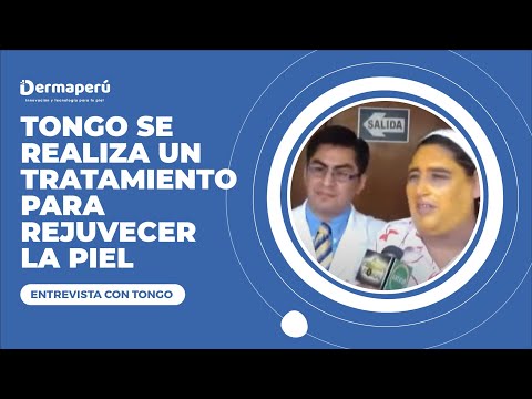 Tongo invita al consultorio – Dr. Aparcana