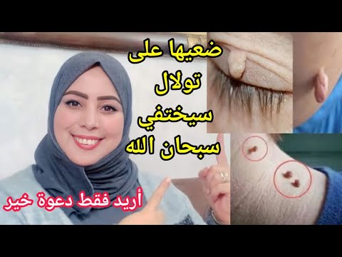 وصفة فعالة جدا سريعةالمفعول للتخلص من الثالول في يومين فقط سيختفي ويموت/علاج الزوائدالجلدية نهائيا4k
