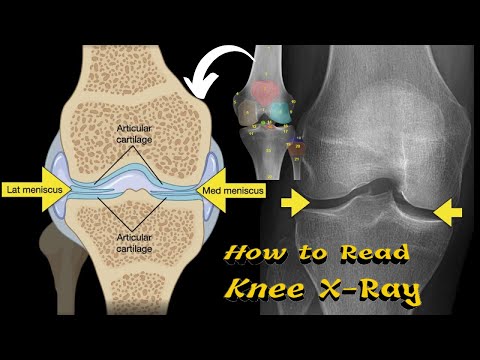 What is a C Arm Machine and How to work Working principle of C Arm Uses