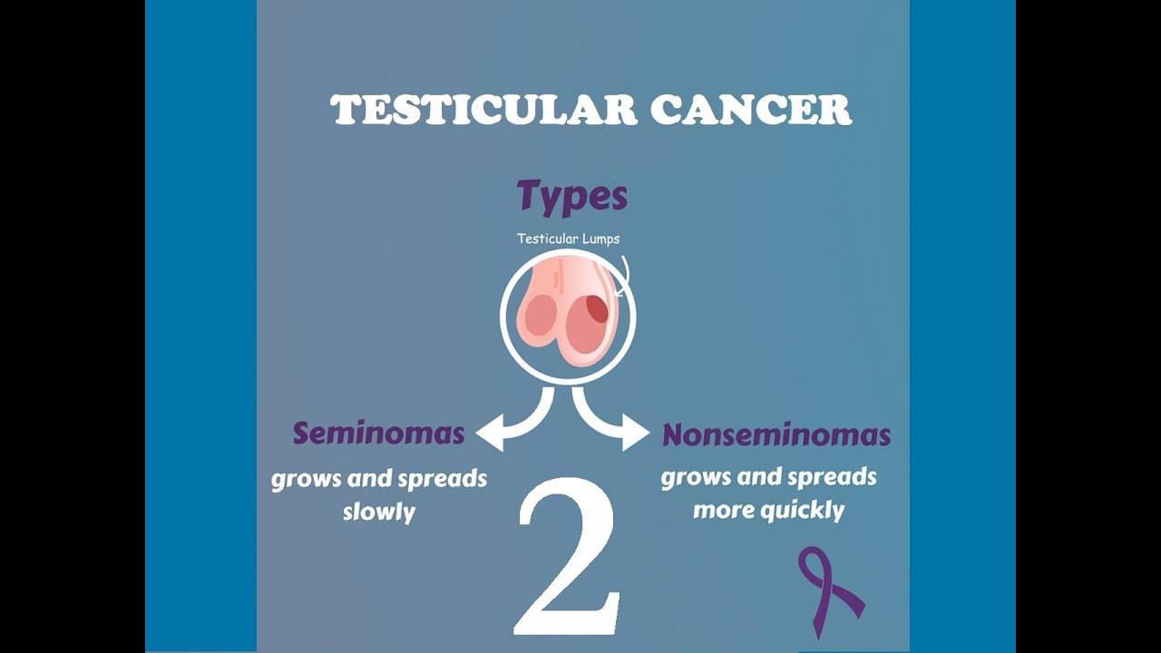 Testicular Tumors Pathology (2) with mnemonics