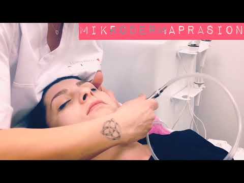 Mikrodermabrasion