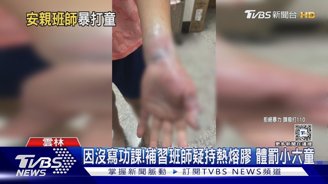 因沒寫功課!補習班師疑持熱熔膠 體罰小六童