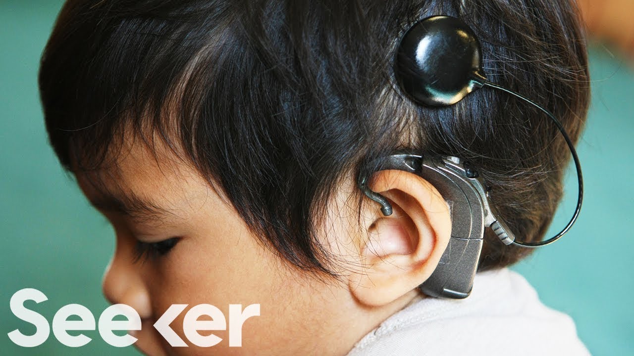 How Do Cochlear Implants Work? - YouTube
