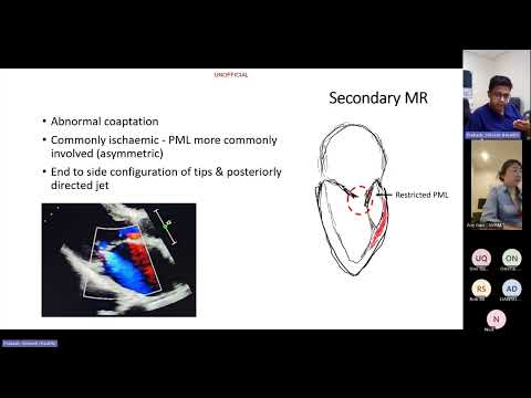 Mitral Regurgitation