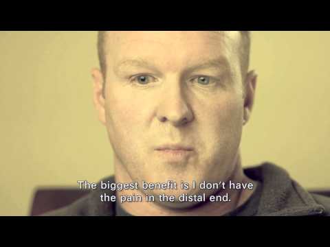 UltraPulse SCAAR FX: Changing Scars, Changing Lives | Lumenis