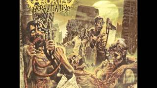 Download lagu Aborted - Coronary Reconstruction mp3 Download lagu Aborted - Coronary Reconstruction mp3