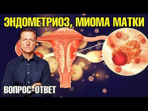 Устраните дефицит ЭТОГО витамина и забудете про эндометриоз!🙌 Устраните дефицит ЭТОГО витамина и забудете про эндометриоз!🙌
