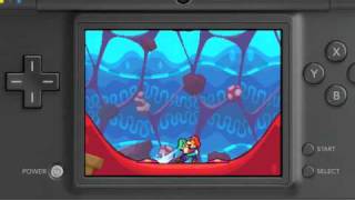 Mario &amp; Luigi Bowser's Inside Story Belly Laughs Vignette