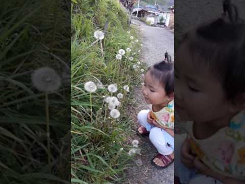 ผลกระทบในเด็กโรคสะเก็ดเงิน โรคผิวหนังภูมิแพ้รักษาอาการ