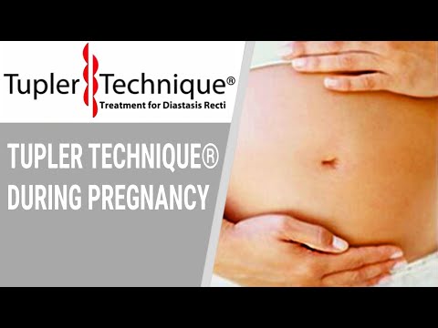 Tupler Technique® During Pregnancy- Julie Tupler RN