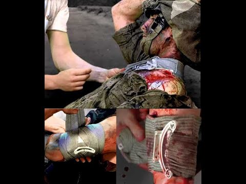 How to apply the Israeli pressure dressing.